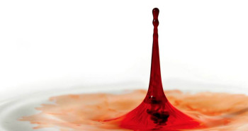 Sangue nas Fezes - Dr Fabio Atui Cirurgia do Aparelho Digestivo e Coloproctologia