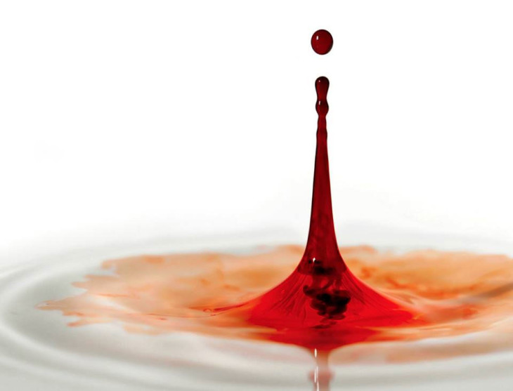 Sangue nas Fezes - Dr Fabio Atui Cirurgia do Aparelho Digestivo e Coloproctologia