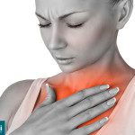 Refluxo gastroesofágico - Por Dr Fabio Atui