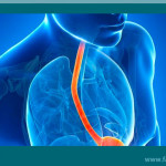 Existe-cirurgia-para-refluxo-gastroesofagico-Dr-Fabio-Atui-03-08-2015