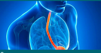 Existe-cirurgia-para-refluxo-gastroesofagico-Dr-Fabio-Atui-03-08-2015