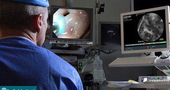 Endoscopia - Por Dr. Fabio Atui